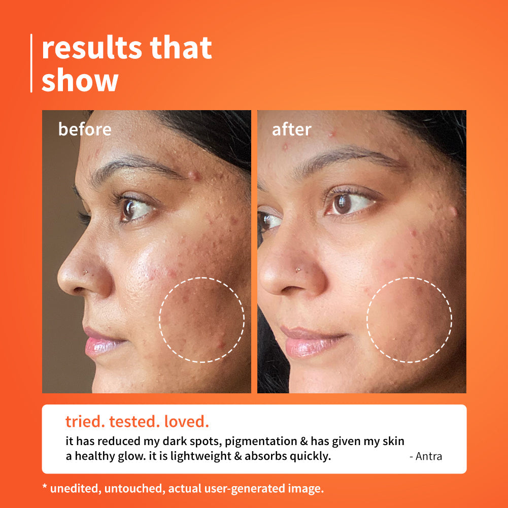 Plum 10% Vitamin C Barrier Boosting + Glow Serum with Calendula | Boosts Glow From 1st Use | Fades Dark Spots In 14 Days | Dermat-Tested, 30ml x 2