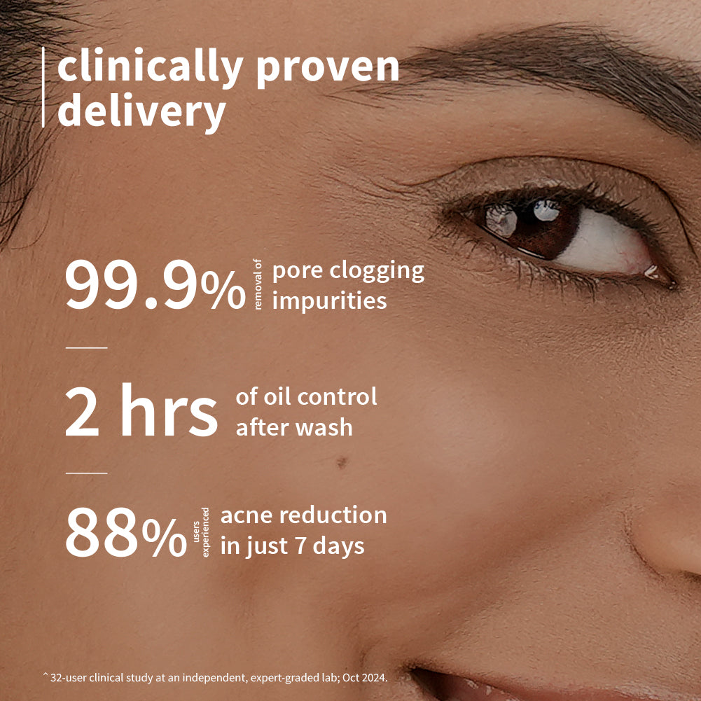 Pore-fectly Bright Combo for Oily, Acne-prone skin with Green Tea Face Wash, Niacinamide Toner & Niacinamide Gel Cream