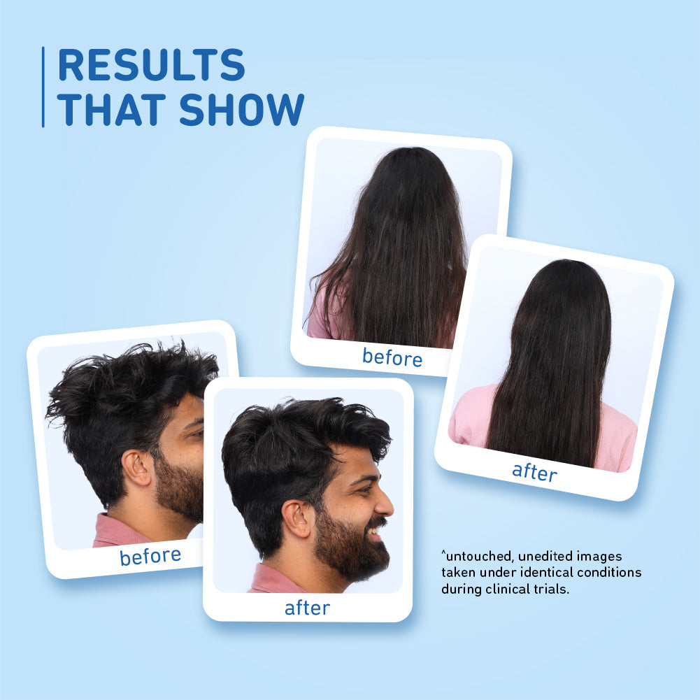 Plum Coconut Milk & Peptides Shampoo | Softens Strands | Nourishes Hair, 250ml