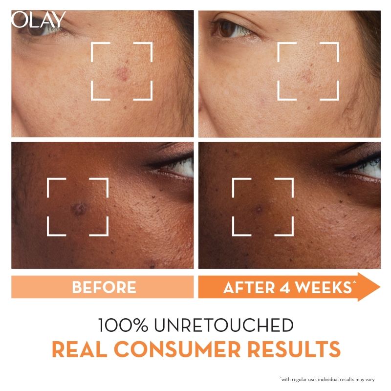 Olay Vitamin C Kit - Super Serum, 30ml With Free Cleanser, Reduces 5 Years Of Stubborn Dark Spots, 100ml Combo, 30ml+100g Buy at Indicrest Image 4