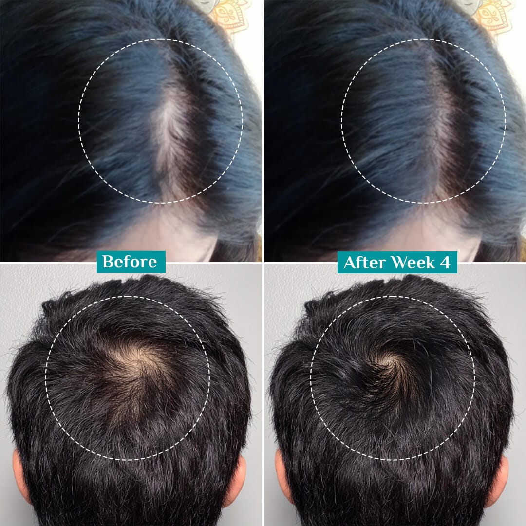 Pilgrim 3% Redensyl, 4% Anagain & 5% Capilia Stem Cell Complex Advanced Hair Growth Serum Roll-On, 30ml - Image 8 - Buy from Indicrest