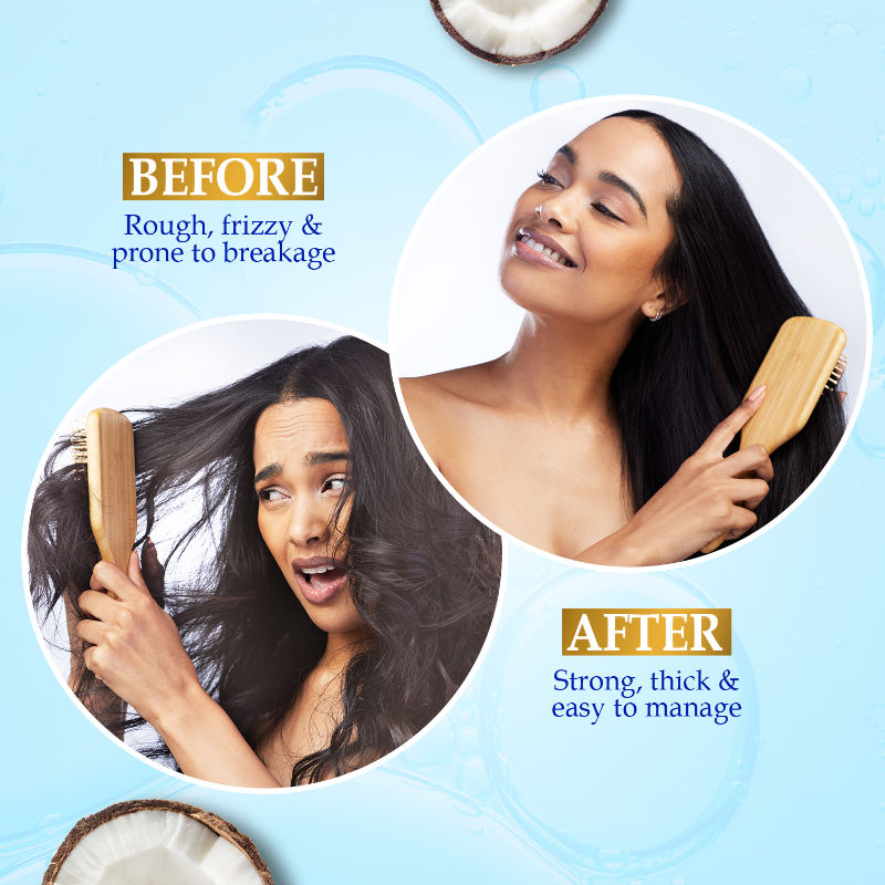 Parachute Advansed Gold Keratin Coconut Hair Oil, 300ml Buy at Indicrest Image 5