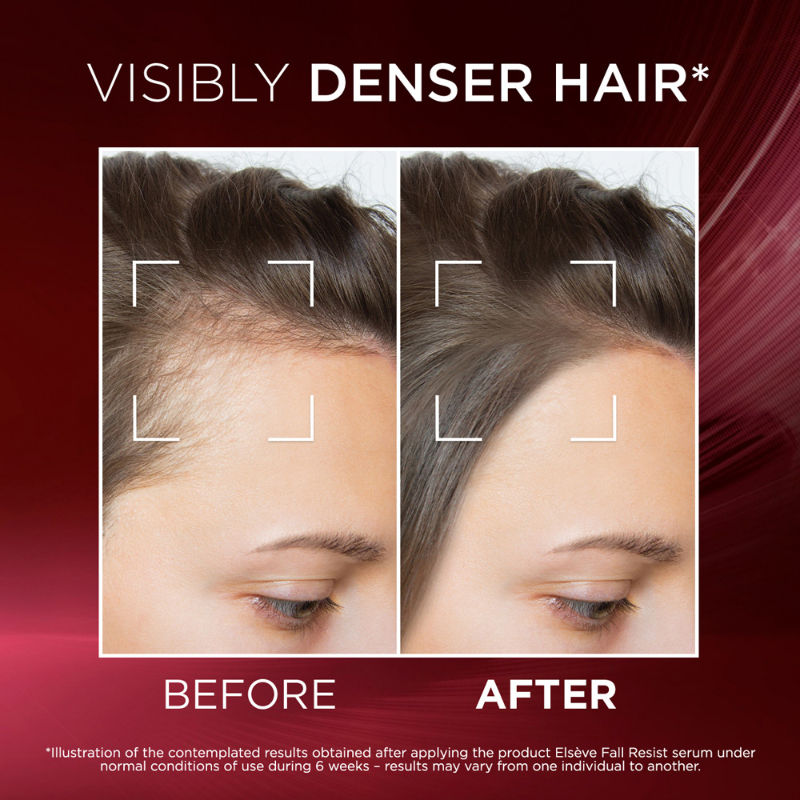 L'Oréal Paris Fall Resist Anti Hair Fall Serum with 1.5% Aminexil, Caffeine & Arginine., 102ml Buy at Indicrest Image 5
