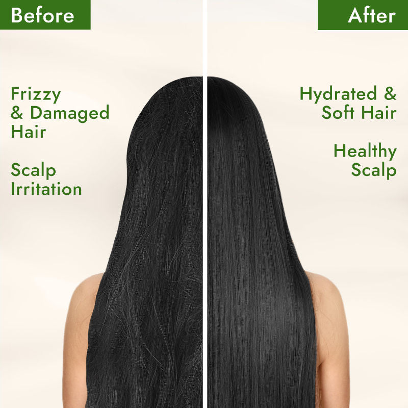 Parachute Advansed Aloe Vera Enriched Coconut Hair Oil, 300ml