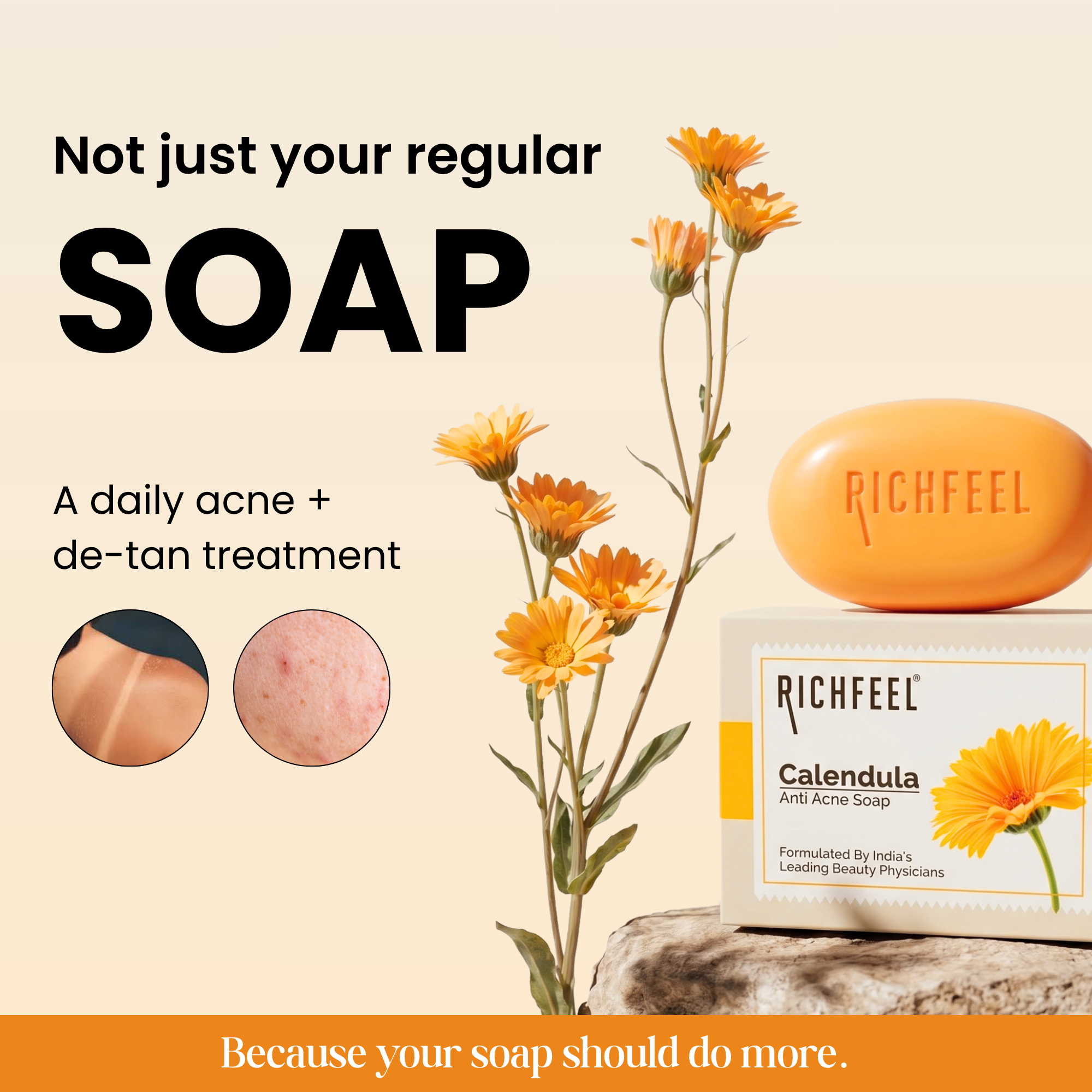 Richfeell Calendula Anti Acne Soap 75 G Pack of 3 - Image 2 - Buy from Indicrest