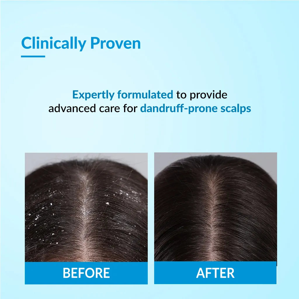 Fixderma Bioteez Advance Shampoo, 75ml - Image 3 - Buy from Indicrest