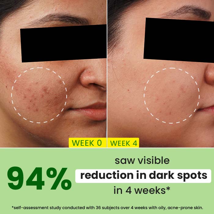 Dot & Key Cica + 10% Niacinamide Face Serum for Oily Skin, 30ml