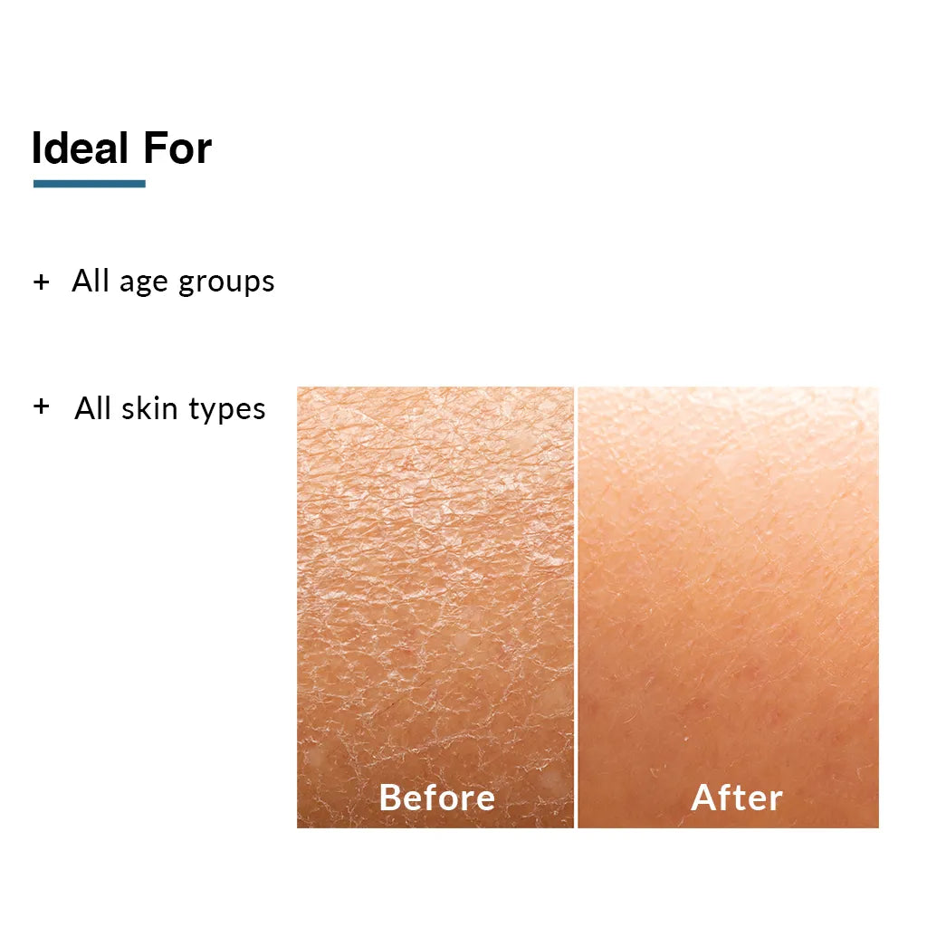 Fixderma Moisturizing Lotion | Perfect Solution To Provide Optimal Hydration For Dry Skin, 150ml - Image 3 - Buy from Indicrest