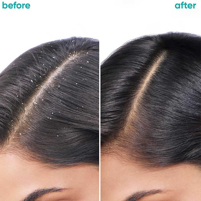 Biolage Aminexil Hair Treatment Pack, Reduces Hair Loss from Roots, 10x6ml, 6ml Each Buy at Indicrest Image 4