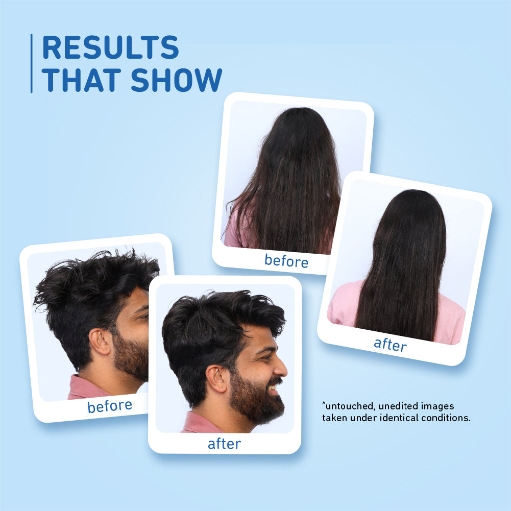 Plum Coconut Milk & Peptides Shampoo | Softens Strands | Nourishes Hair, 250ml