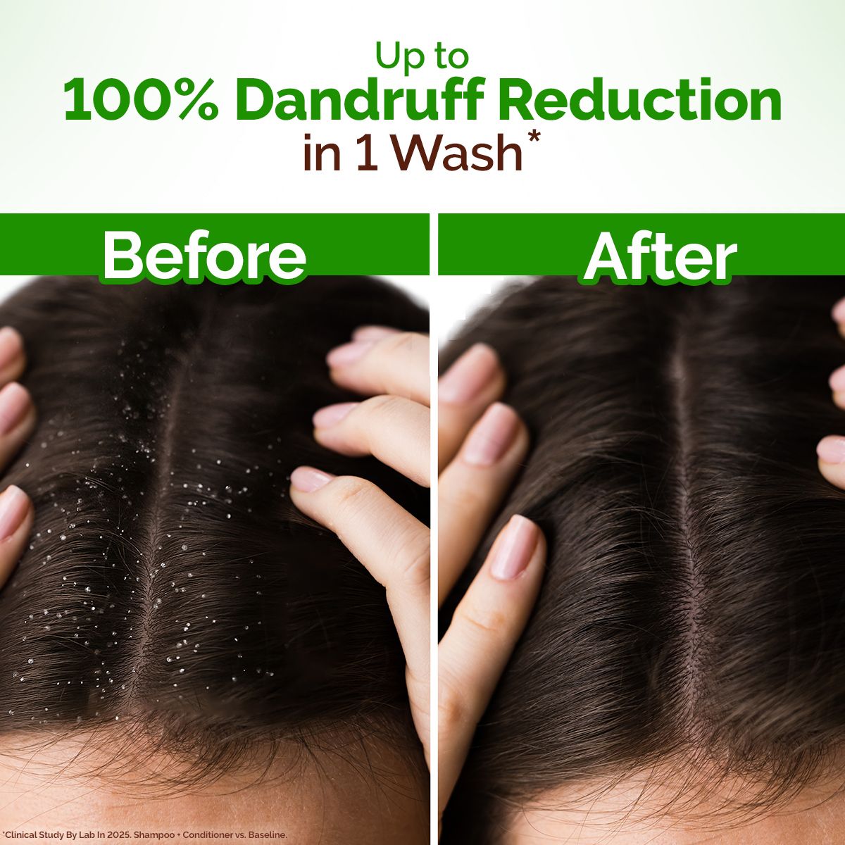Mamaearth Lemon Anti-Dandruff Shampoo with Lemon & Aloe Vera for Itchy & Flaky Scalp, 600ml - Image 4 - Buy from Indicrest
