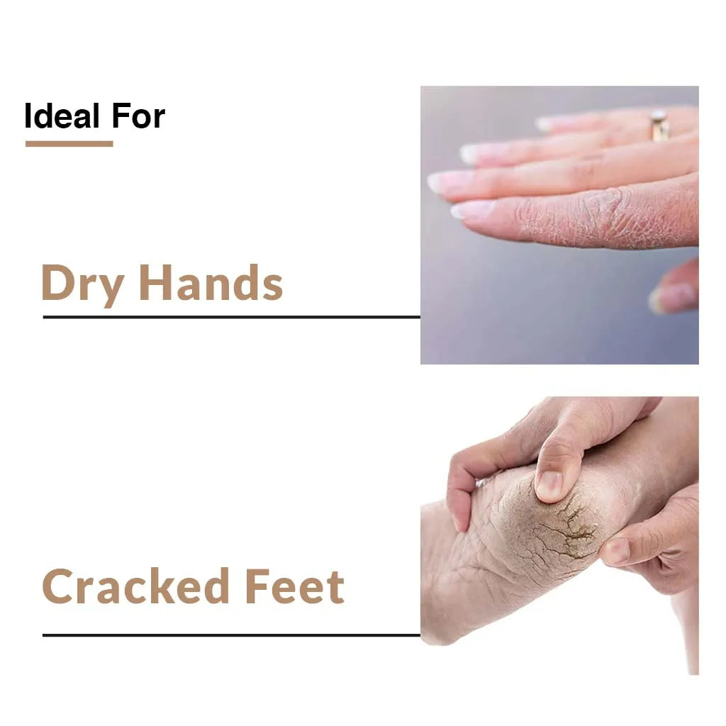 Fixderma Hand and Foot Cream Combo | Repair, Hydrate and Revitalize Dry Hands & Cracked Heels, Lip Shield 15g + Sunscreen 40g - Image 4 - Buy from Indicrest