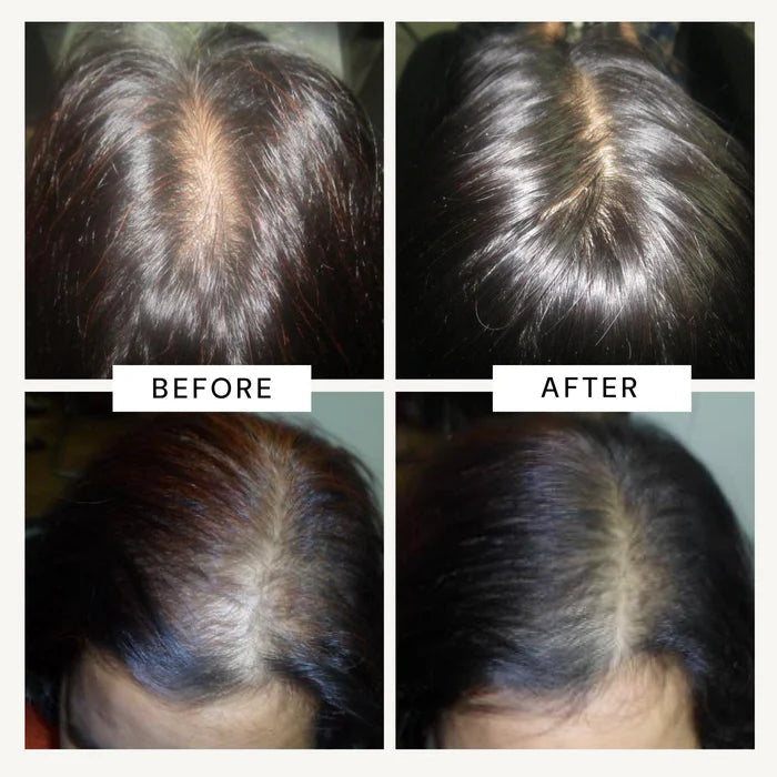 Anagrow - Advanced Hair Growth Serum With Plant Cells - Image 4 - Buy from Indicrest