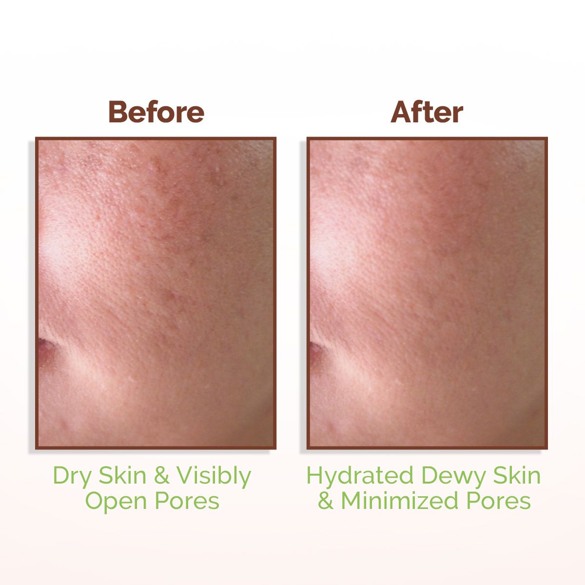Mamaearth Rice Water Dewy Face Toner with 96% Pure Rice Water Extract & 4% Niacinamide for Glass Skin, 150ml - Image 5 - Buy from Indicrest