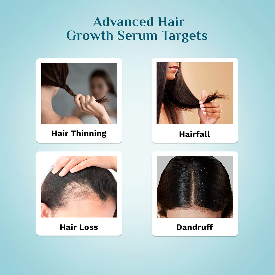 Pilgrim 3% Redensyl & 4% Anagain Advanced Hair Growth Serum For Dandruff-Prone Scalp, 30ml - Image 5 - Buy from Indicrest