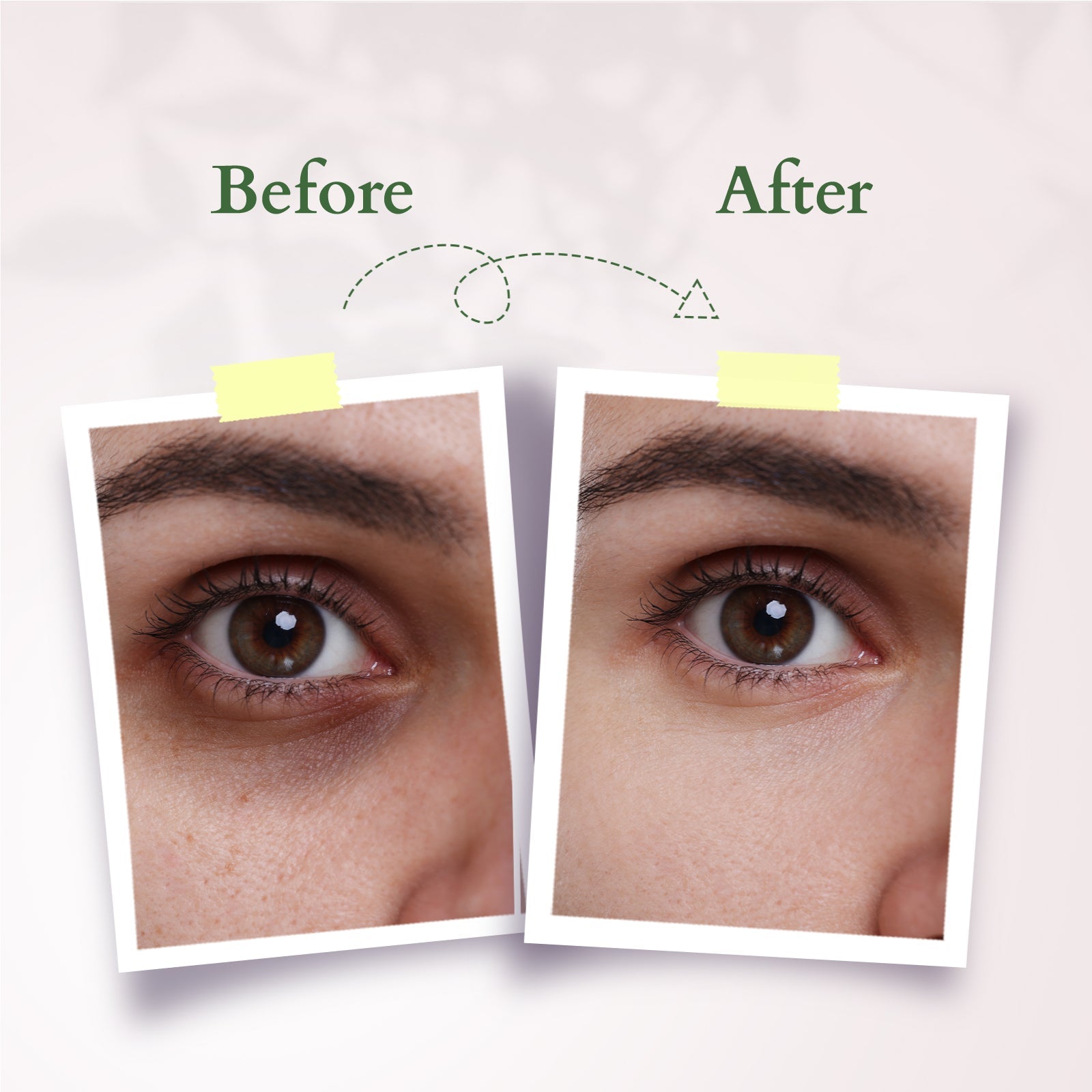 Lotus Herbals Precious Brightening Under Eye Cream, 15ml