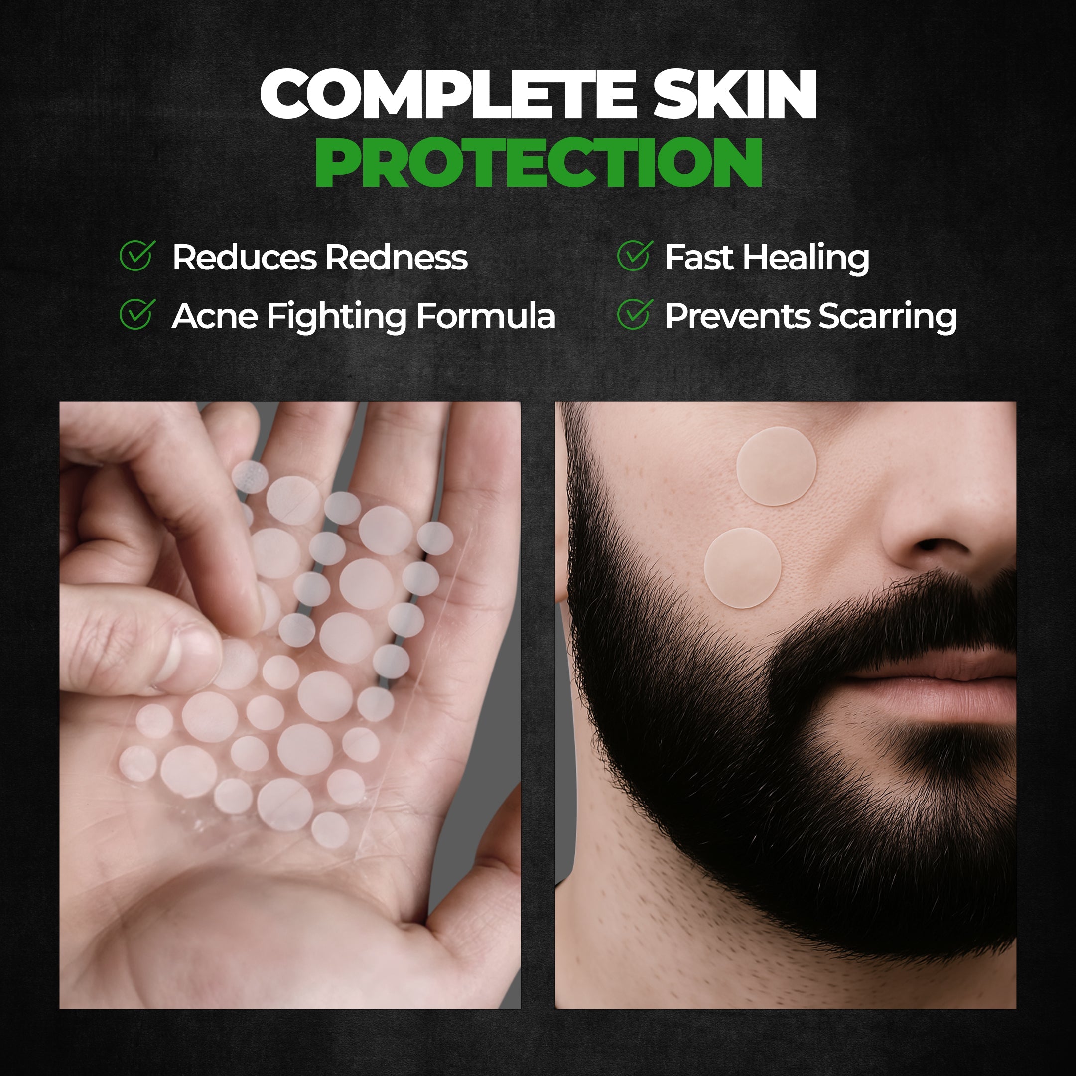 Beardo Doctor Acne Pimple Patch - Image 6 - Buy from Indicrest