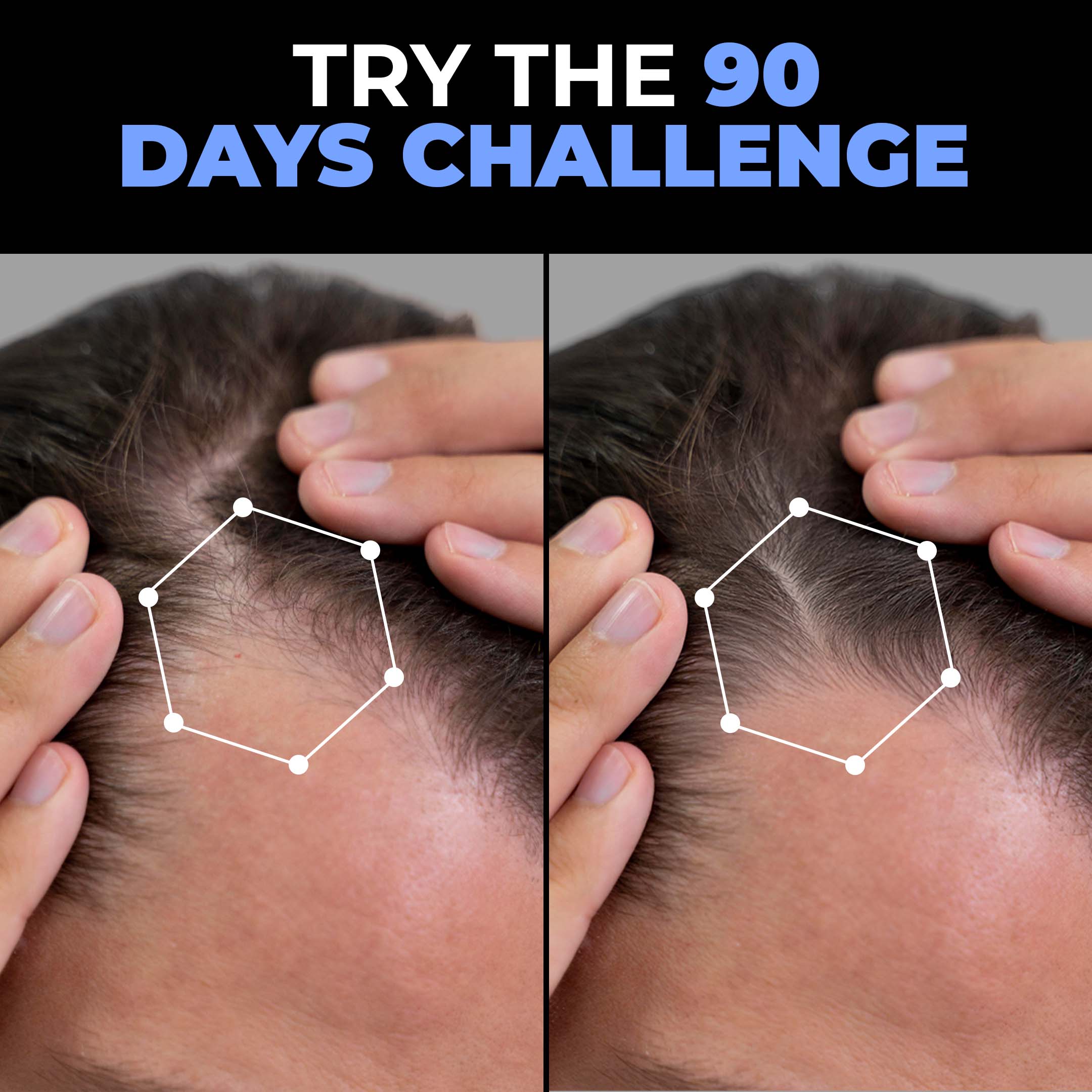 Beardo Hair Growth Regimen - Image 6 - Buy from Indicrest