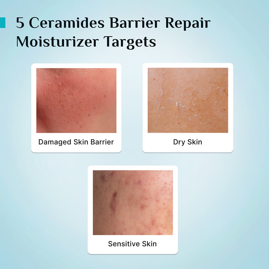 Pilgrim 5 Ceramides Barrier Repair Moisturizer, 100g - Image 6 - Buy from Indicrest