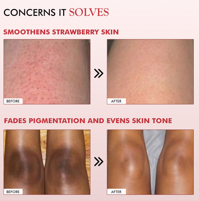 Mcaffeine 11% AHA BHA Strawberry Body Lotion for Skin Smoothening, 200ml - Image 6 - Buy from Indicrest