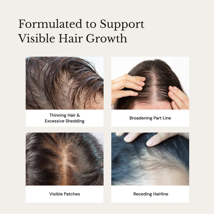 Anagrow - Advanced Hair Growth Serum With Plant Cells - Image 5 - Buy from Indicrest