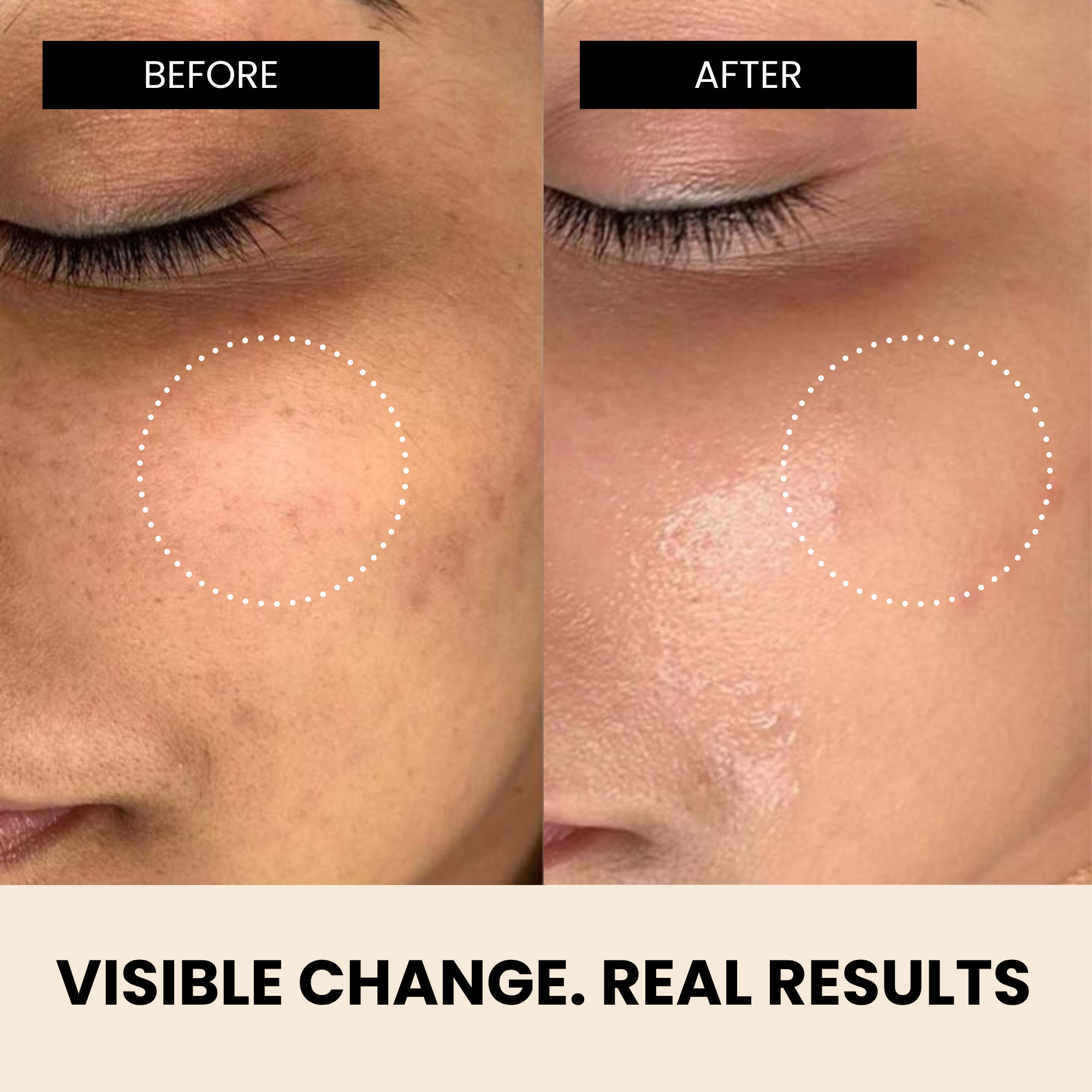Richfeell Skin Brightening Day Serum 10 Ml - Image 6 - Buy from Indicrest