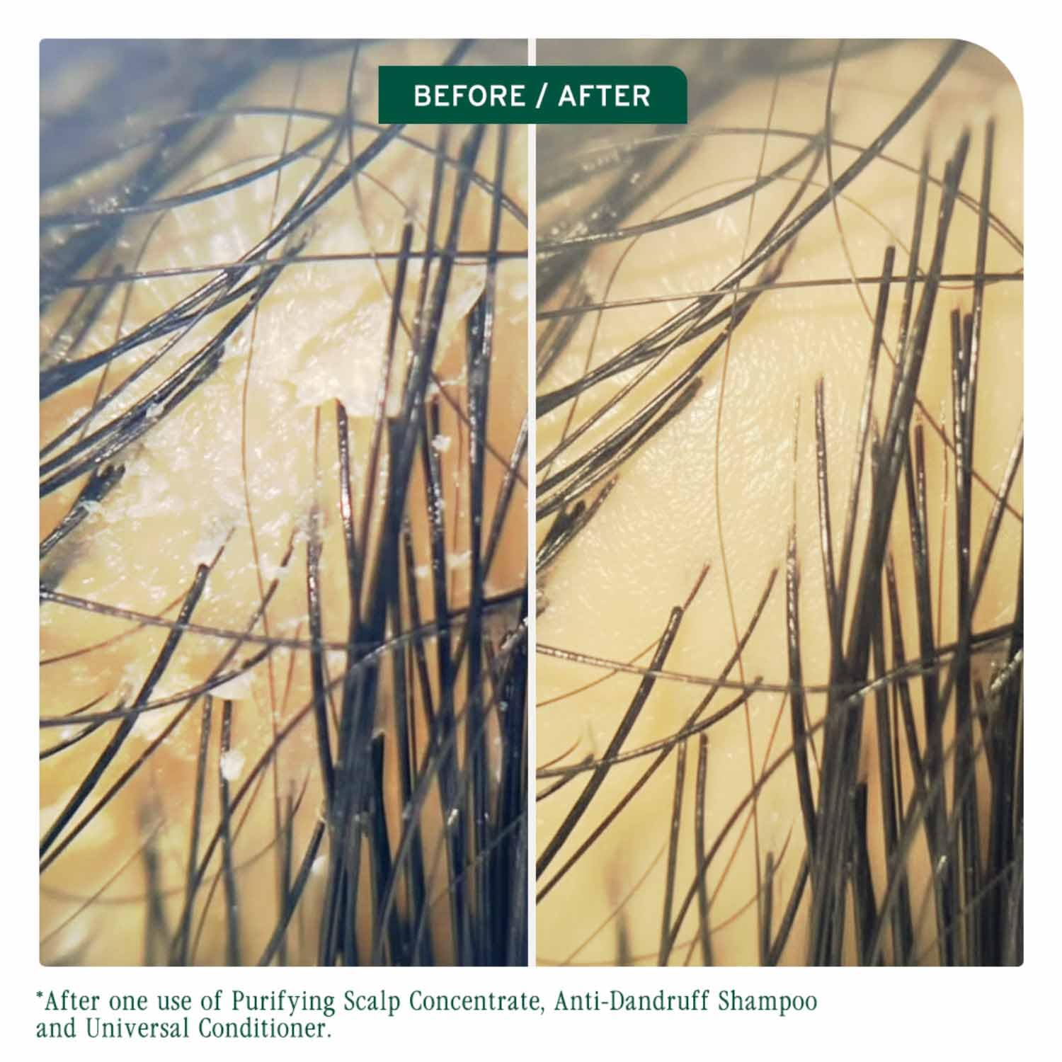 Matrix Biolage Advanced Scalp Sync Shampoo, 200ml