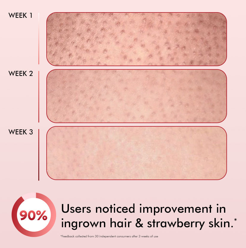 Mcaffeine 11% AHA BHA Strawberry Body Lotion for Skin Smoothening, 200ml - Image 7 - Buy from Indicrest