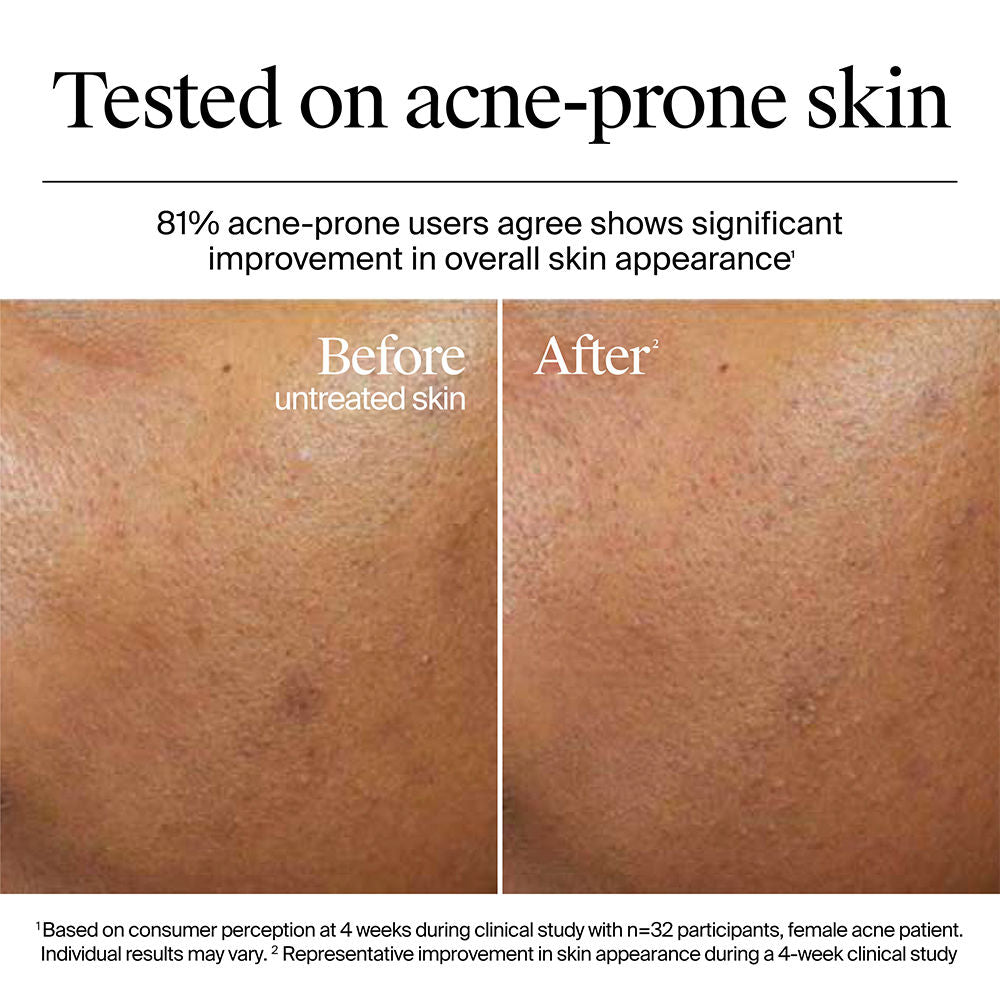 Neutrogena Dry Skin Moisturizer Home + Travel Combo, Nourshing Cream 50g + Water Gel 13g
