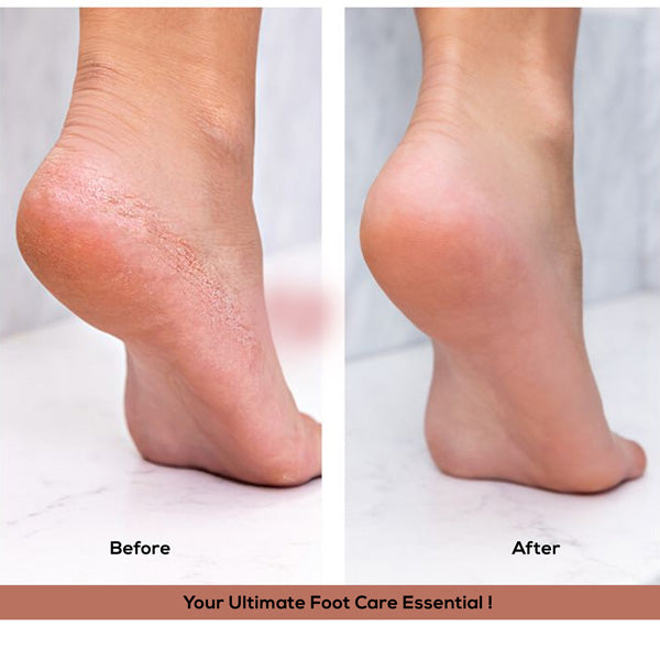 Ikonic Basics Foot File IKB-707C