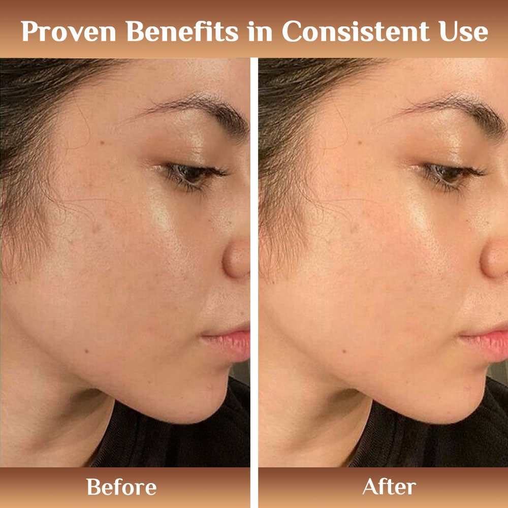 Richfeell Skin Brightening Day Serum 25ML - Image 6 - Buy from Indicrest