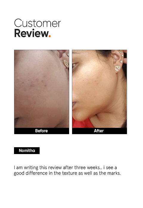 Minimalist AHA PHA BHA 32% Face Peel For Weekend Exfoliating Facial, 10ml - Image 5 - Buy from Indicrest