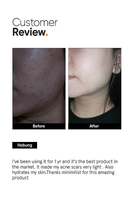 Minimalist Alpha Arbutin 2% Face Serum For Reduces Dark Spots, Marks &amp; Evens Skin Tone, 10ml - Image 5 - Buy from Indicrest