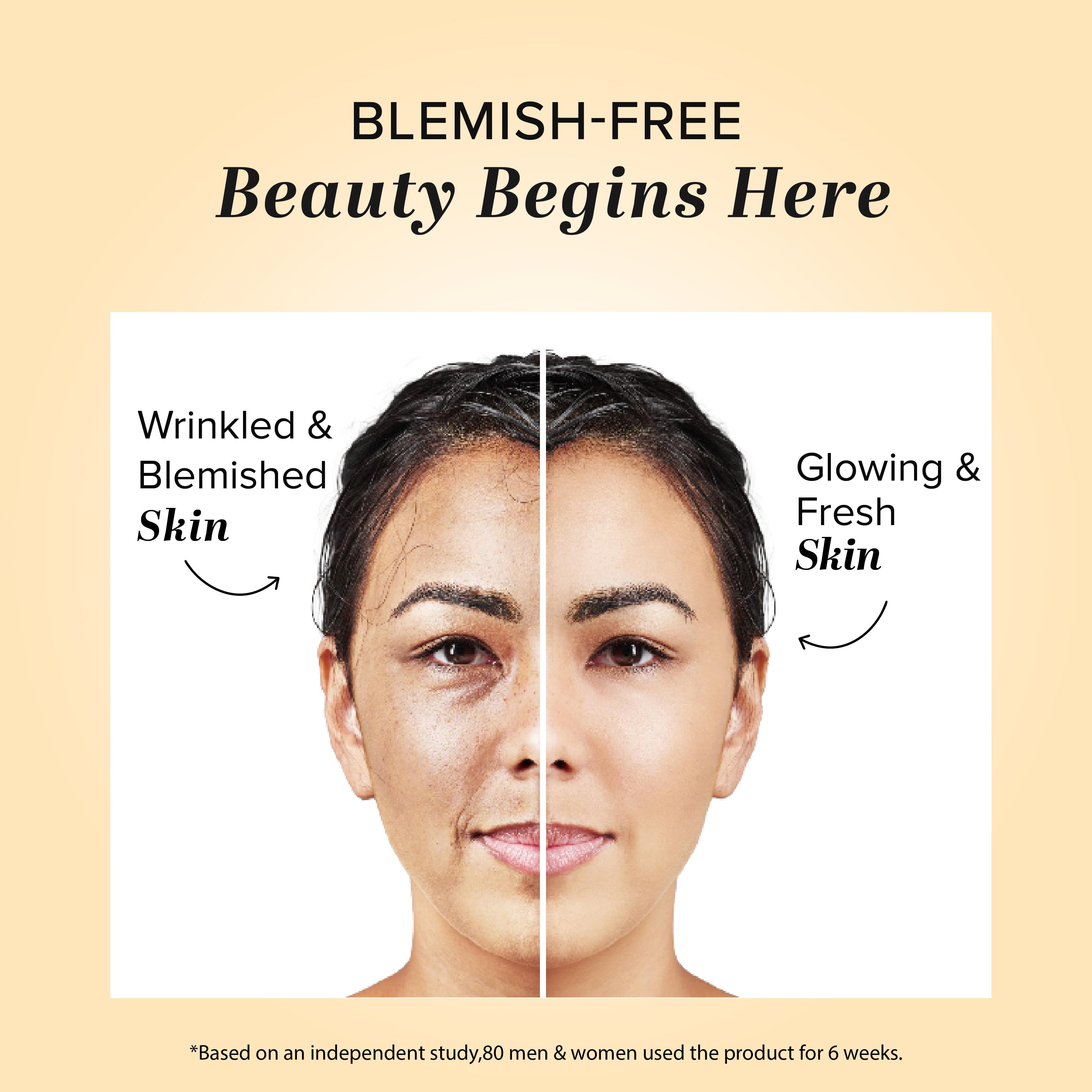 Khadi Natural Herbal Anti Blemish Cream - 50gm - Image 5 - Buy from Indicrest