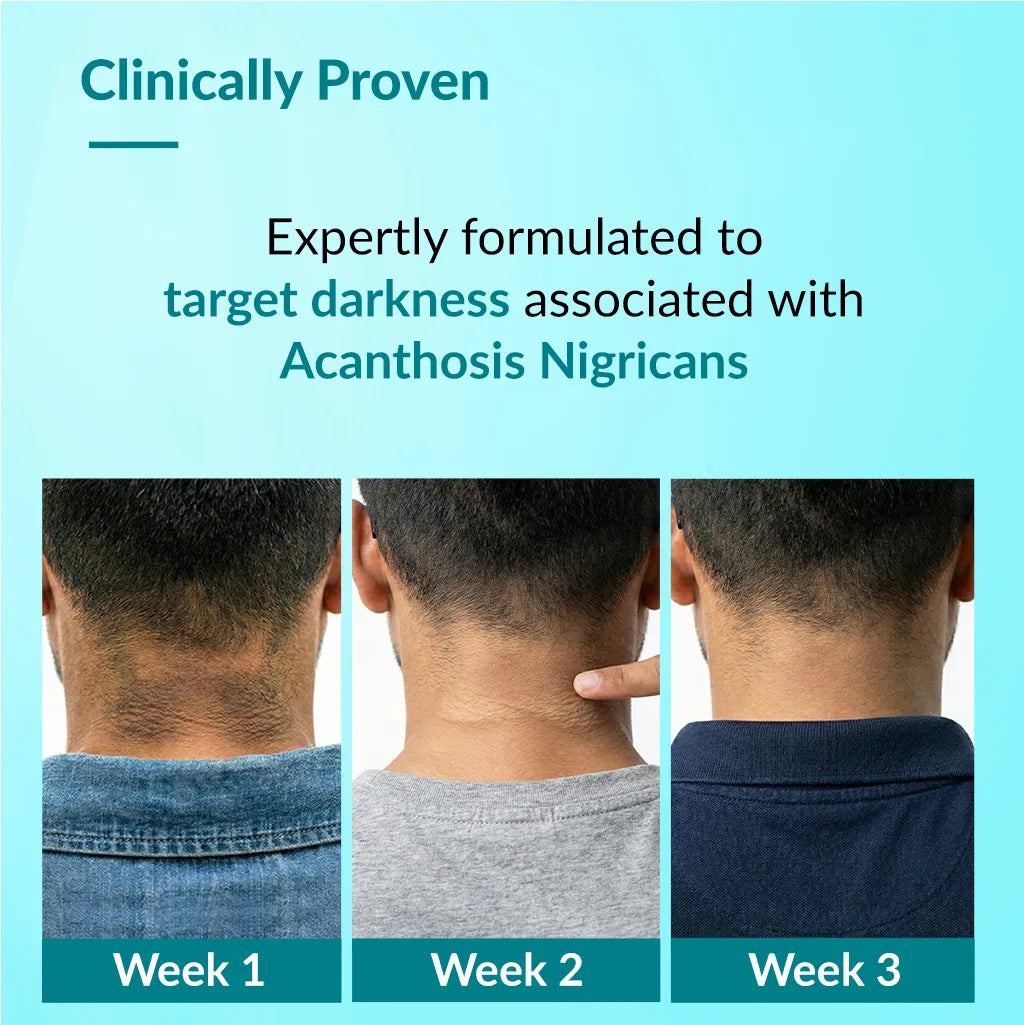 Fixderma Nigrifix Advance Cream, 50g - Image 3 - Buy from Indicrest
