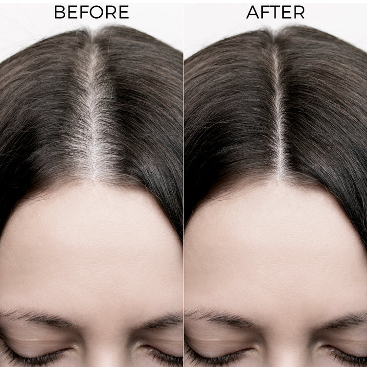 Brillare Caffeine & Redensyl Scalp Serum For Hair Growth, 30ml - Image 4 - Buy from Indicrest