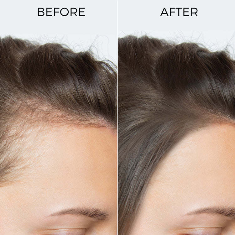 Brillare 100% Rosemary Essential Oil for Hair Growth, 15ml - Image 6 - Buy from Indicrest