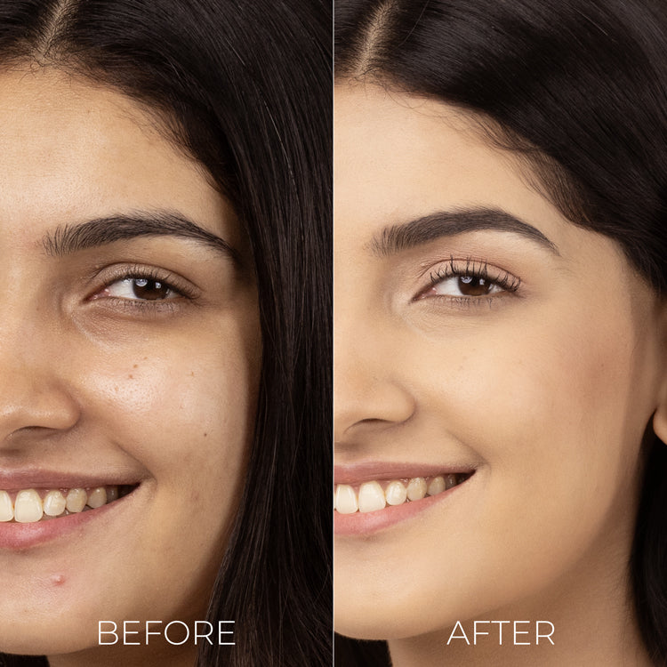 Brillare Mini Salicylic Acid Liquid Moisturiser for oily, acne prone skin, 10ml - Image 4 - Buy from Indicrest