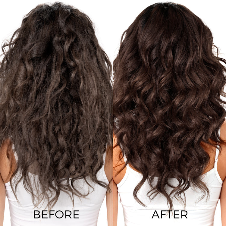 Brillare Ultimate Dandruff Control Kit for Itchy, Flaky Scalp - Image 6 - Buy from Indicrest