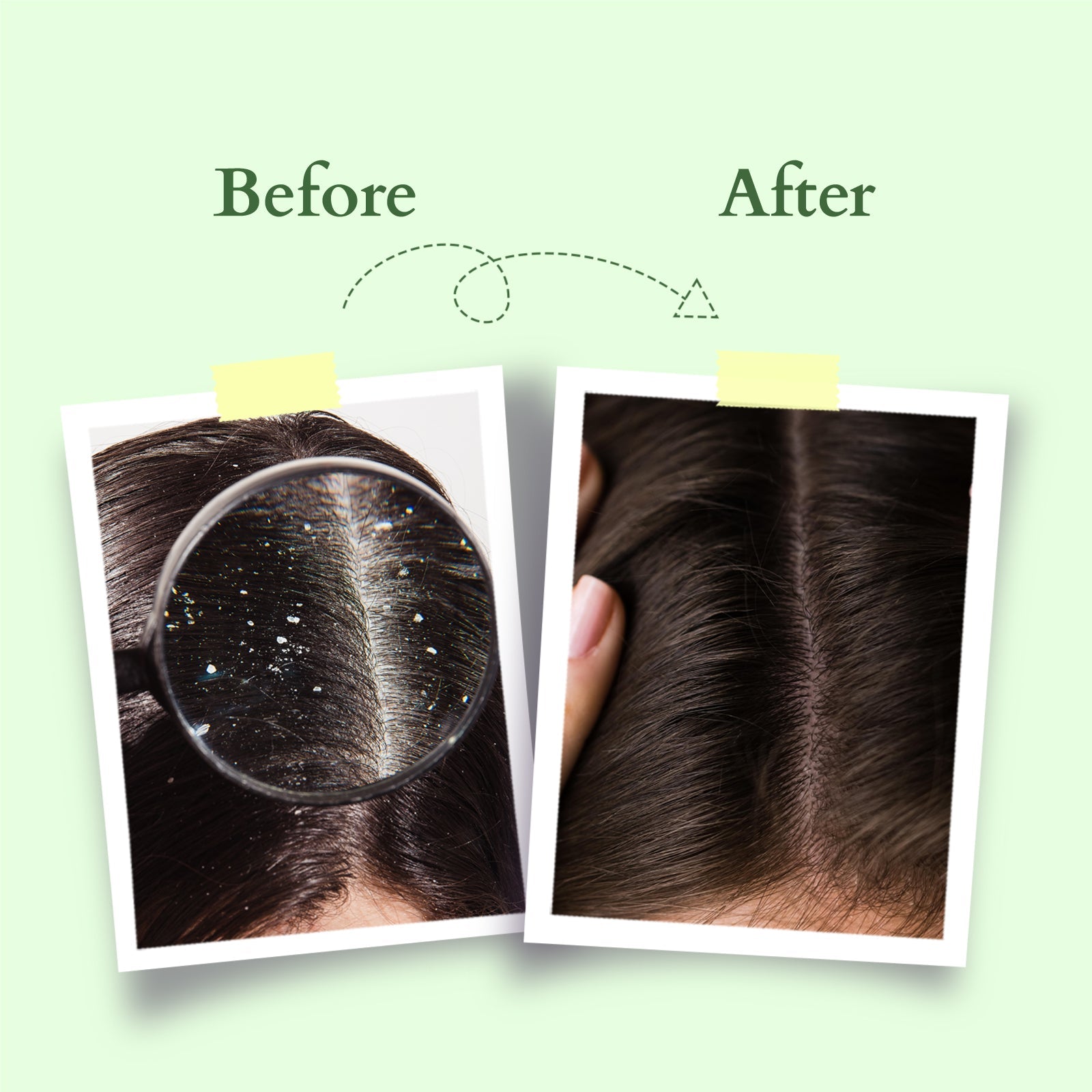 Lotus Herbals Organics+ Chemical-Free Anti-Dandruff Shampoo, 300ml