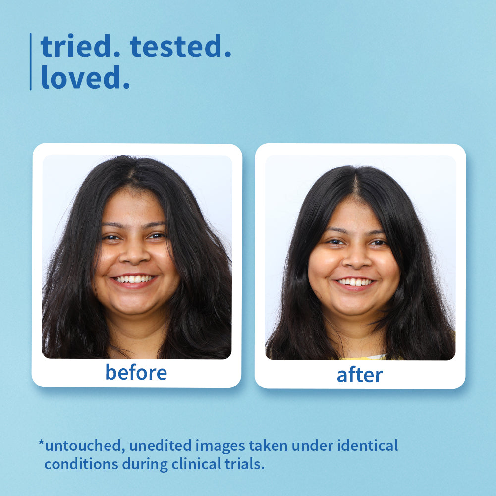 Plum Coconut & Peptides Hair Mask for Dry Hair | Softens Strands | Nourishes Hair, 200g