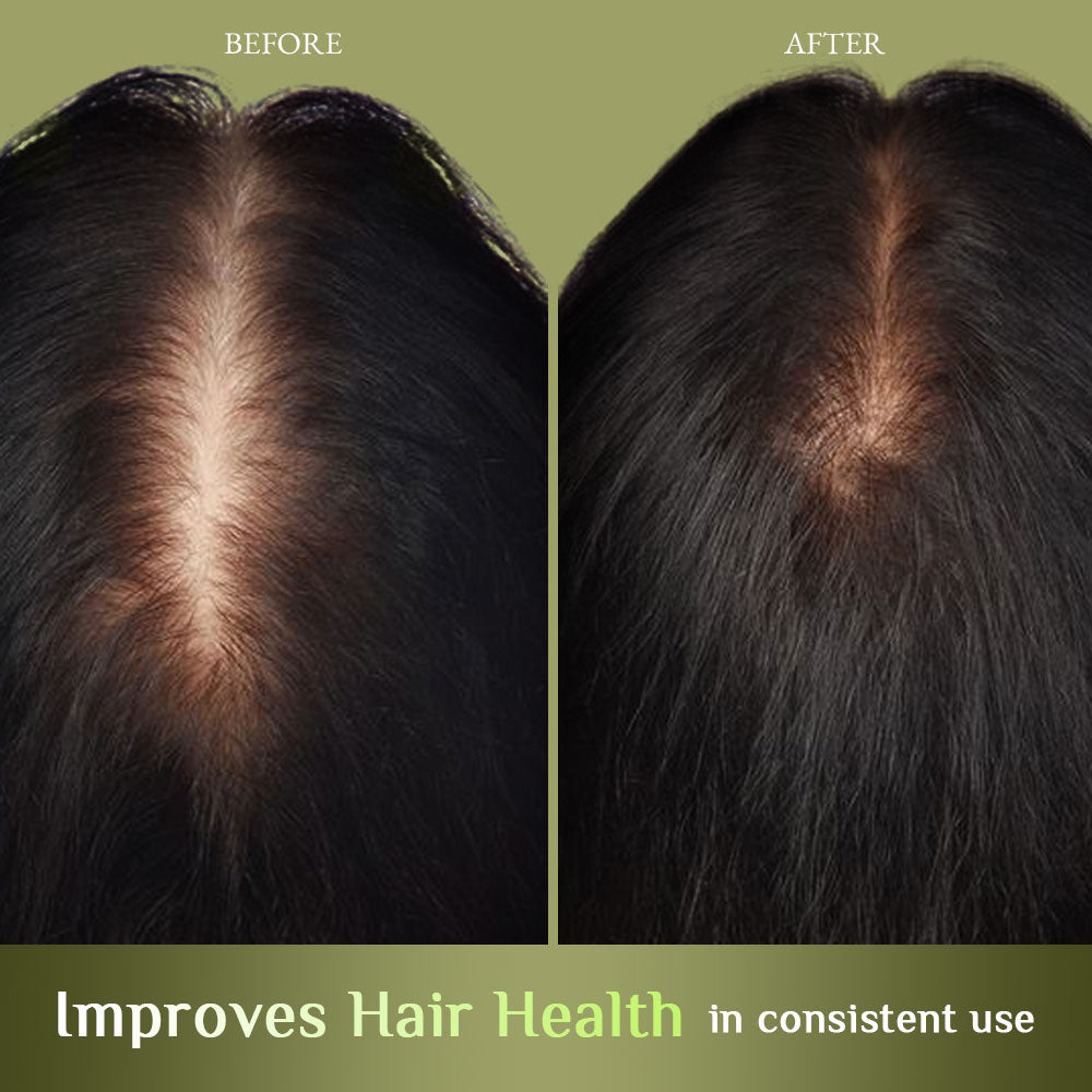 Richfeell Brahmi Jaborandi Hair Oil 500 ML - Image 6 - Buy from Indicrest