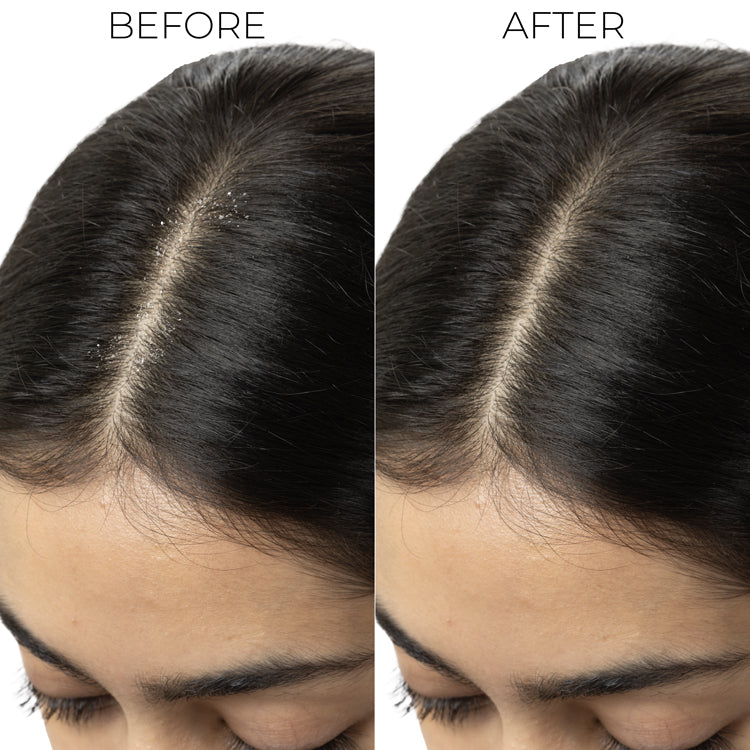 Brillare Dandruff Control Conditioner For Itchy, Flaky Scalp, 125g - Image 4 - Buy from Indicrest