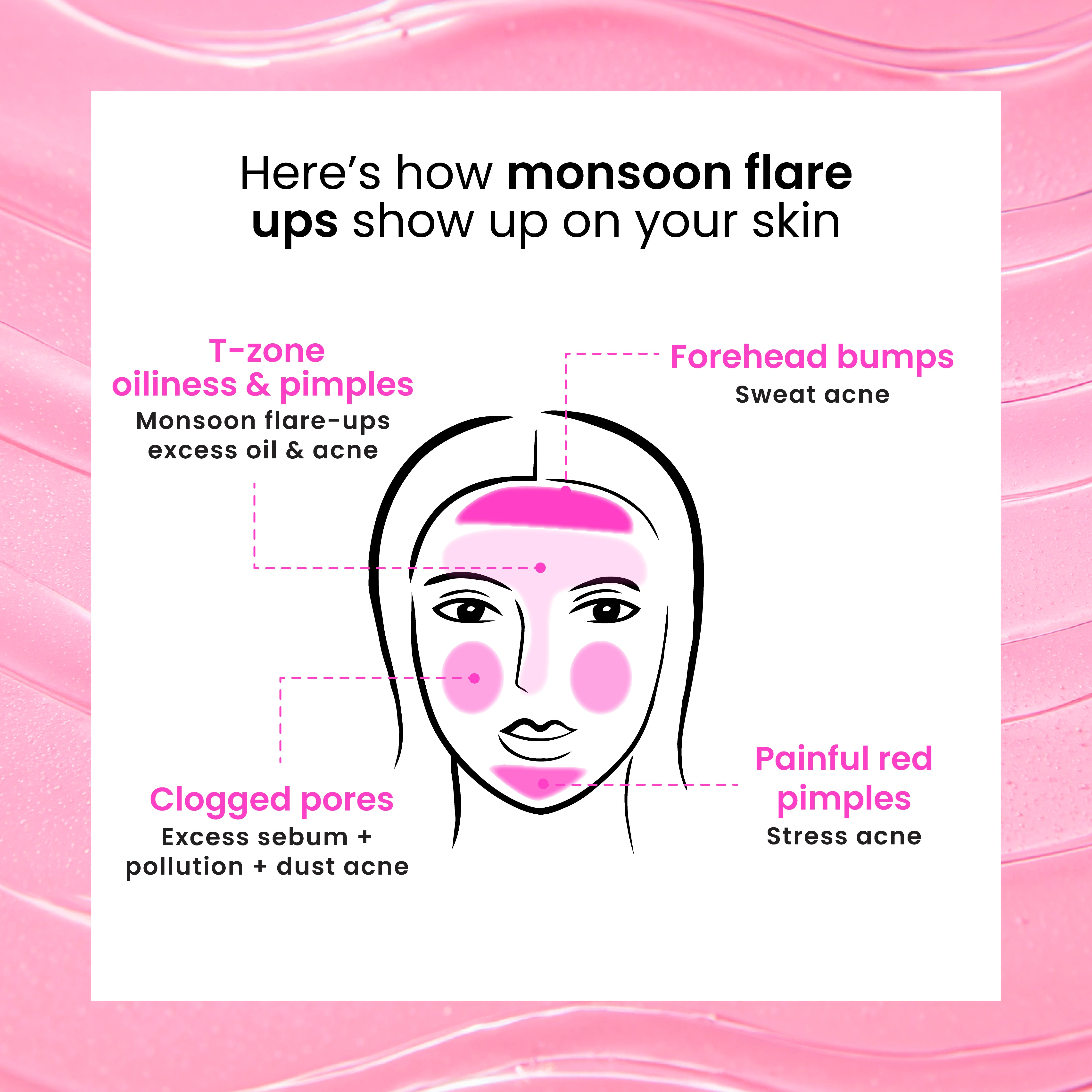 Foxtale Oil & Acne Control Face Wash Controls Excess Oil | Treats Active Acne | Calms Monsoon Flare-Ups in 3 Days | 100ml - Image 6 - Buy from Indicrest