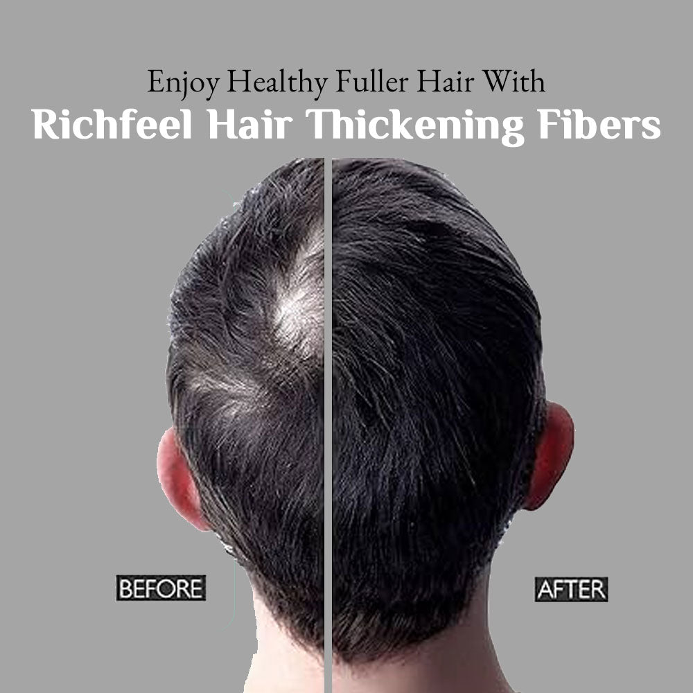 Richfeell Hair Thickening Fibers (RHF) - Image 6 - Buy from Indicrest