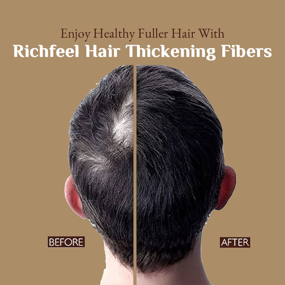 Richfeell Hair Thickening Fibers (RHF) - Image 12 - Buy from Indicrest