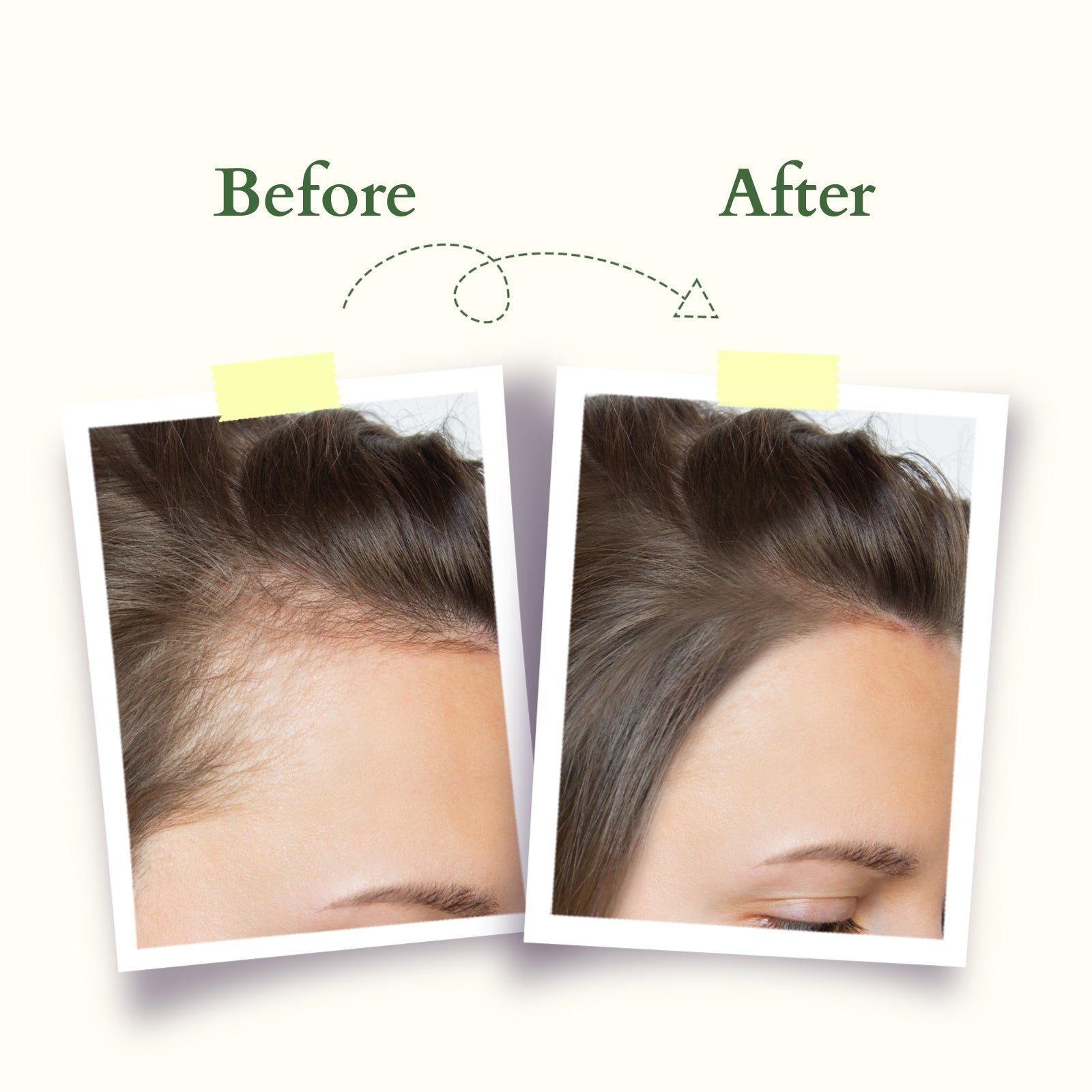 Lotus Herbals Organics+ Intensive Scalp Care Shampoo, 210ml
