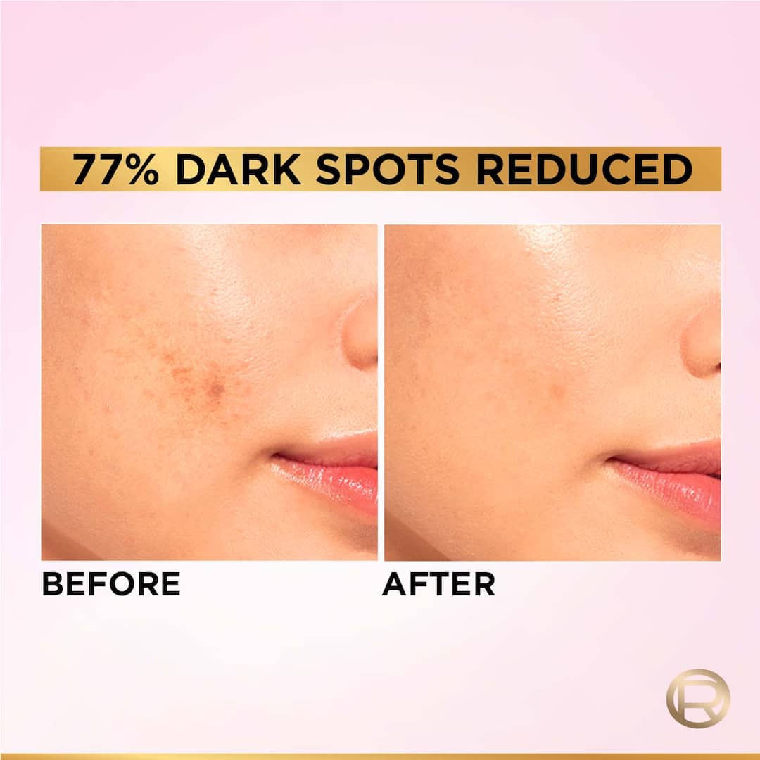 L'Oreal  Paris Glycolic Bright Dark Spot Serum 8% Glycolic Acid – 15ml13