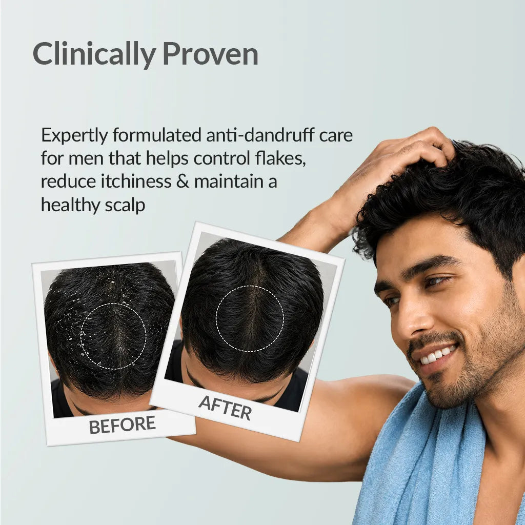 Fixderma FOR MEN Anti-Dandruff Shampoo, 100ml - Image 5 - Buy from Indicrest