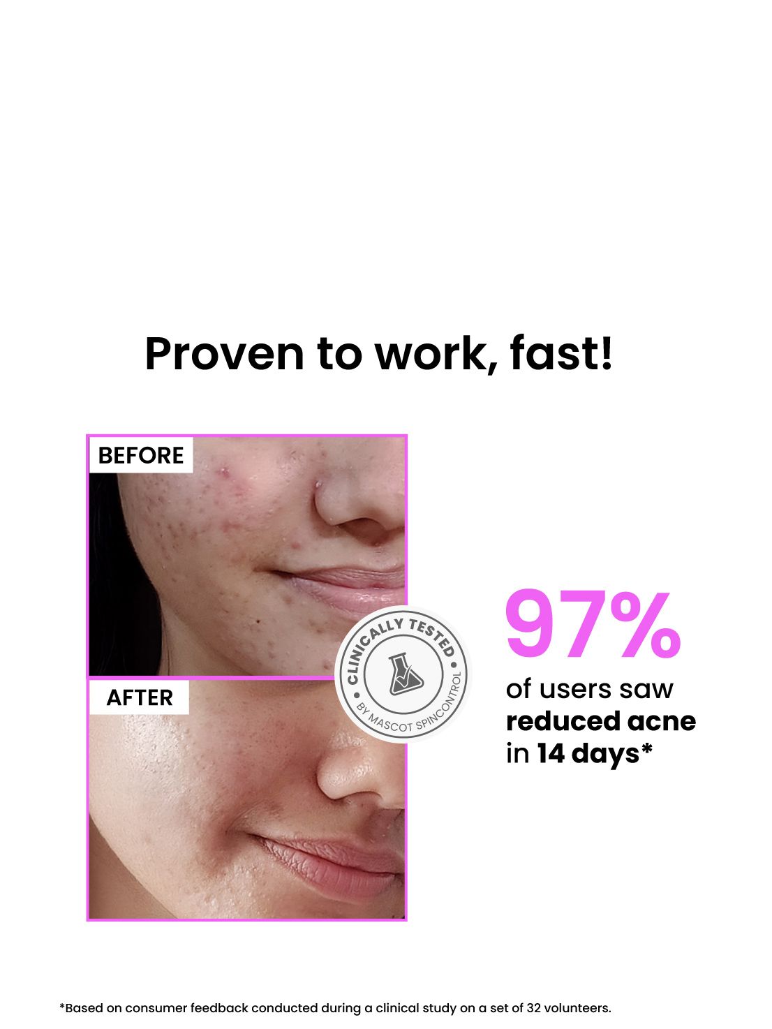 Foxtale 12% Niacinamide Clarifying Serum Controls oil, reduces acne, and fades dark spots in 14 days | 10 ml - Image 7 - Buy from Indicrest